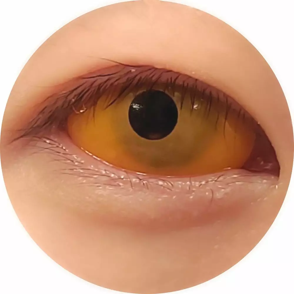 Cherie Contacts Sweety Orange Sclera 1 Cherie Contacts Sweety Orange Sclera